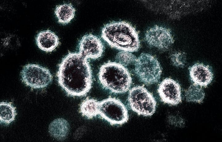 Coronavirus cell